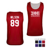 SigEp Personalized Intramural Mesh Tank